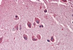 MXRA5 Antibody, Novus Biologicals 0.1mg; Unlabeled:Antibodies, Polyclonal